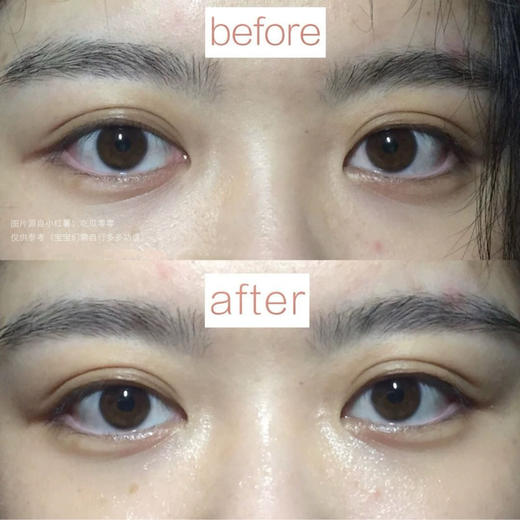 眼纹小熨斗！新版资生堂悦薇珀翡塑颜眼膜淡细纹眼纹抗皱 1对（26.8月） 商品图6