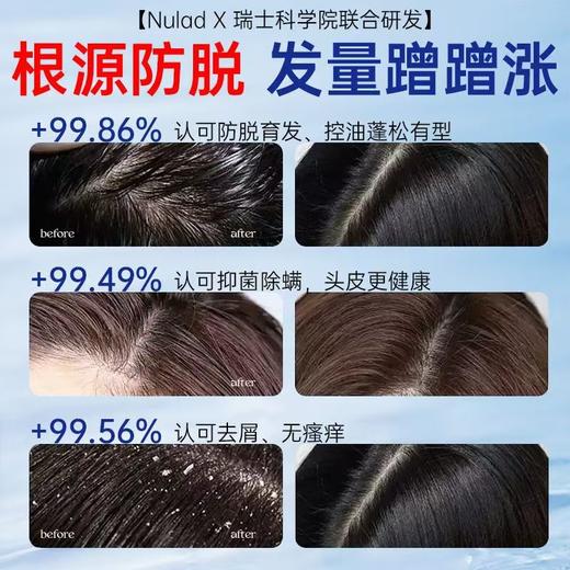 防脱洗发水 商品图1