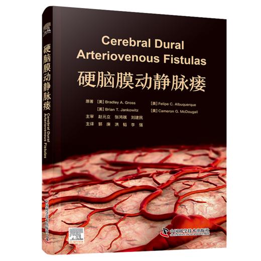新书推荐《硬脑膜动静脉瘘》赵元立，张鸿祺，刘建民主审；郭庚，洪韬，李强教授主译 商品图1