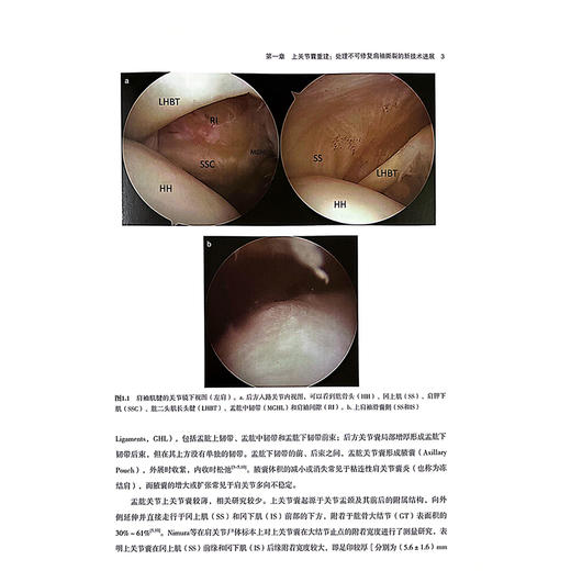 肩关节外科手术技术发展 物理医学和康复在肩部疾病中的作用 肩关节置换术的手术人路 主译李威等辽宁科学技术出版社9787559134912 商品图4