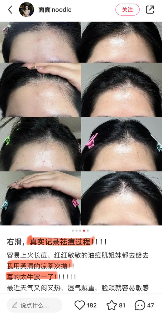 痘敏肌王老吉！芙清凉茶次抛清痘舒缓精华液5支（26.11） 商品图5