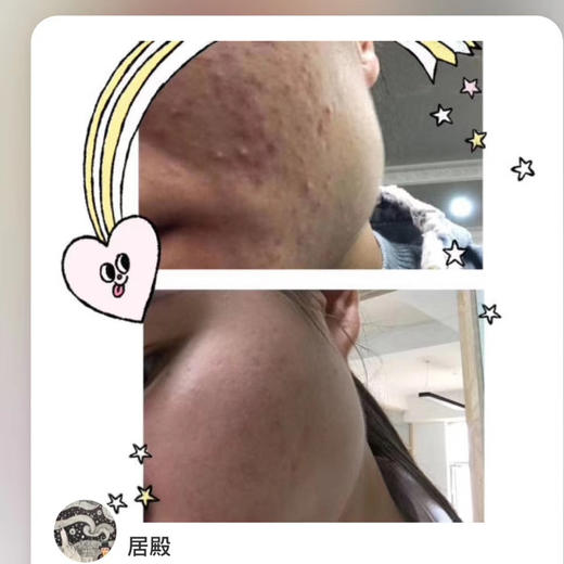 【十余年口碑，新年新鲜入库】A醇（视黄醇）弹力精华油  王炸精华 20ml 复刻媲美某顿金胶 晚上精华步骤 不加防腐剂 体系温和不刺激 油性肌肤不油 干性肌肤不干 商品图2