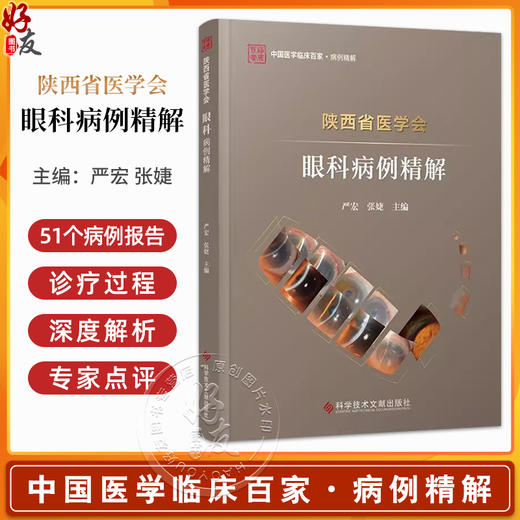 陕西省医学会眼科病例精解科学 青年单眼眼弓形体性脉络膜视网膜炎 妊娠高血压综合征合并视网膜脱离 技术文献出版社9787523512098 商品图0