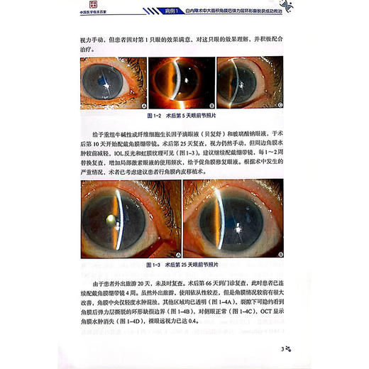 陕西省医学会眼科病例精解科学 青年单眼眼弓形体性脉络膜视网膜炎 妊娠高血压综合征合并视网膜脱离 技术文献出版社9787523512098 商品图4