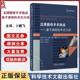 足踝翻修手术挑战基于病例的术式介绍 应用双钢板配合髓内克氏针翻修移位的跖骨头截骨 术科学技术文献出版社 9787523515471