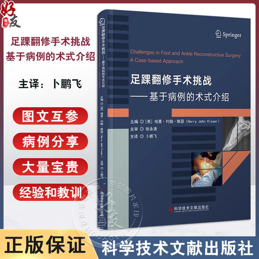 足踝翻修手术挑战基于病例的术式介绍 应用双钢板配合髓内克氏针翻修移位的跖骨头截骨 术科学技术文献出版社 9787523515471 商品图0