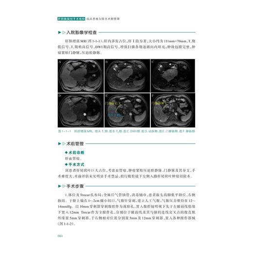 肝胆胰微创手术精粹：临床思维与围手术期管理/张成武主编/浙江大学出版社 商品图4