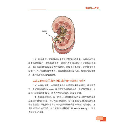 走进尿酸了解痛风 茹晋丽 建立科学生活方式 预防高尿酸血症和痛风普及健康生活远离生活方式病科学技术文献出版社9787523512630 商品图4