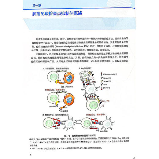 免疫检查点抑制剂不良事件识别与管理 各系统免疫检查点抑制剂不良事件识别与管理 主编杨润祥 孔光耀人民卫生出版社9787117358354 商品图4