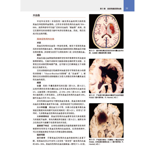 奥斯本脑部影像诊断学精要 商品图2