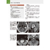 奥斯本脑部影像诊断学精要 商品缩略图5