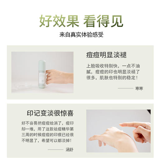 梵秀伊净痘修护精华液30ml 商品图3