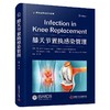 膝关节置换感染管理  主译  郑稼 辽科出版 商品缩略图0