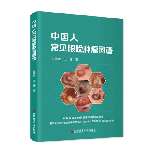 中国人常见眼睑肿瘤图谱 德勃 眼睑肿瘤病变特点52种疾病340例患者近600张图片着色性干皮 科学技术文献出版社9787523514283 商品图1