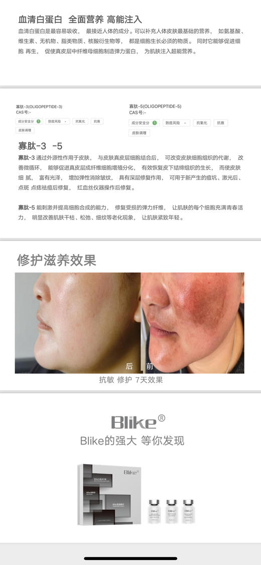 Blike光速白绝斑套可拆卖一次装 提亮肤色淡化色斑色素沉着 商品图5