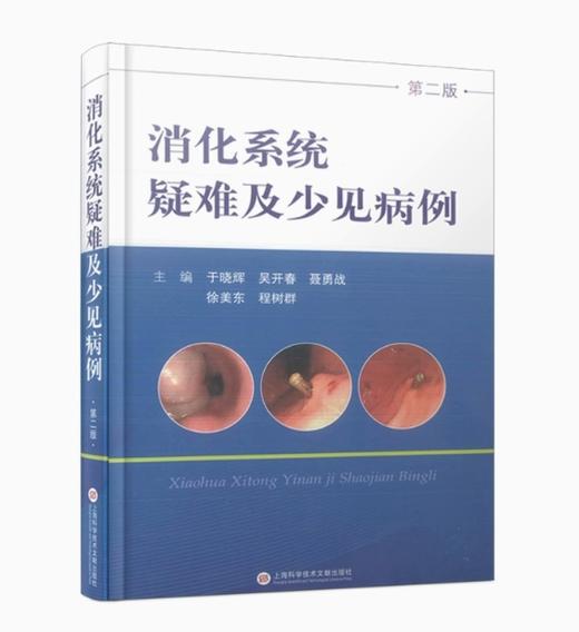(病例系列）消化系统疑难及少见病例 商品图0