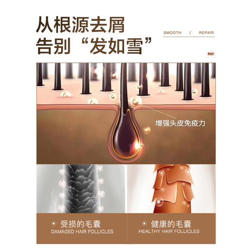 伊护去屑控油洗发乳 商品图5