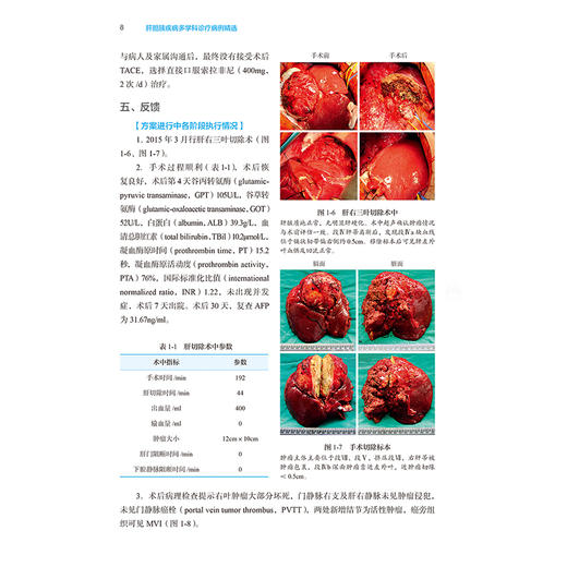 正版全新 肝胆胰疾病多学科诊疗病例精选 陈孝平 张必翔 主编 肝脏胆管胰腺疾病诊断MDT临床病例 人民卫生出版社 9787117365048 商品图4