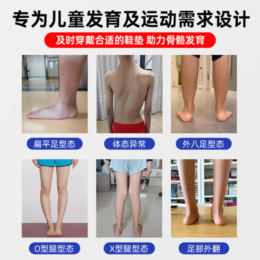 赛优姿 3D 轻矫形鞋垫 商品图2