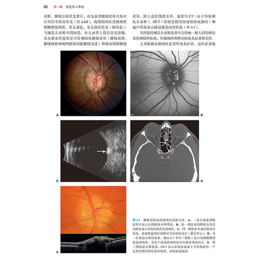 沃尔什与霍伊特临床神经眼科学 第4版  魏世辉 黄厚斌 张文芳 主译 北京大学医学出版社9787565931888 商品图4