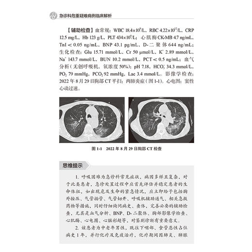 急诊科危重疑难病例临床解析 顾伟 主编 肺曲霉菌 卡氏肺孢菌 胸痛的真相等北京大学医学出版社 9787565932090 商品图4