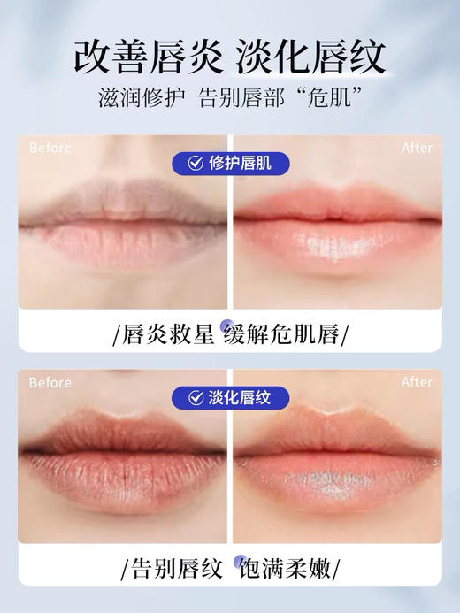 【岁末秒杀】资生堂B6润唇膏唇-口角炎霜-滋润保湿 商品图3