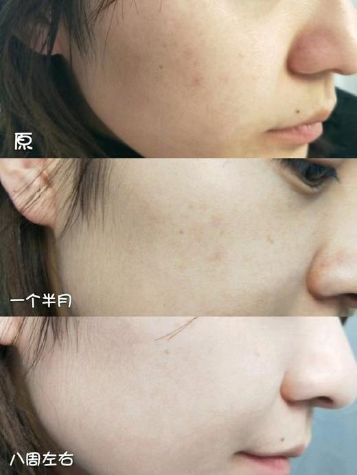 【清仓好价】森特莲美白淡斑精华50ml（效期至24.10） 商品图3