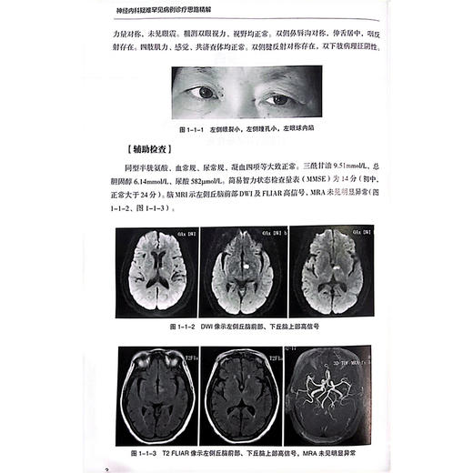 神经内科疑难罕见病例诊疗思路 中枢神经系统炎性疾病 神经系统感染 自身免疫相 主编王金涛等 辽宁科学技术出版社9787559137296 商品图4