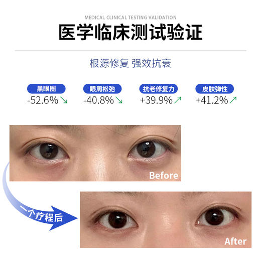 铂鱼眼周精华 淡化黑眼圈 淡化眼袋 抚平皱纹逆龄修护 提拉紧致 商品图2