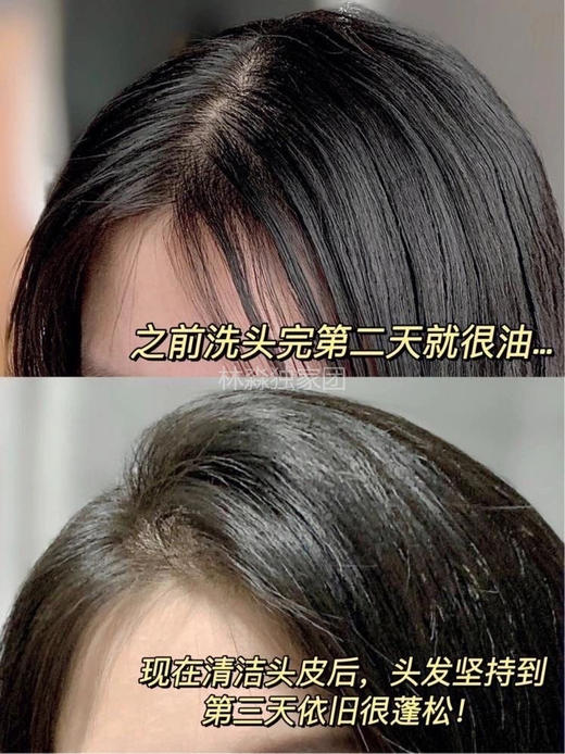 【9.8王炸割肉价】The bodyShop美体小铺生姜洗发水400ml*2（限25年6月） 商品图6