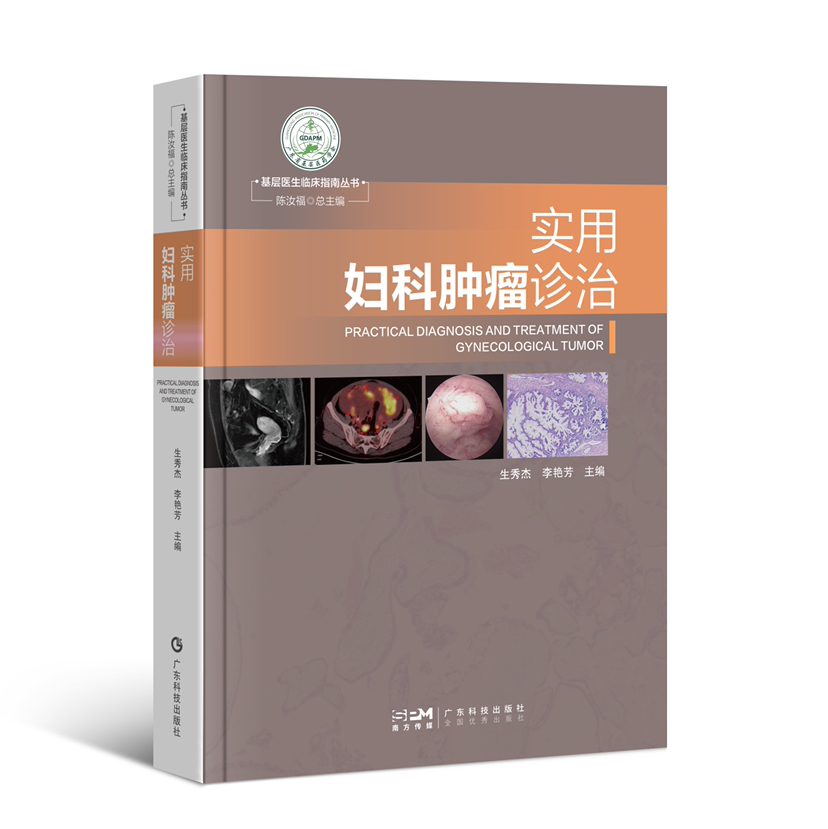 实用妇科肿瘤诊治