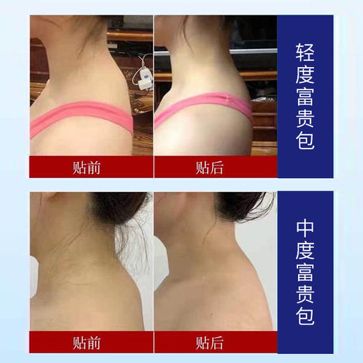 【到手5盒】SMEK富贵包贴，十几种名贵中虫草成分，一贴=20次艾灸十推拿十按摩，一贴就管用，亲肤无纺布，久贴不闷肤，全身可用，哪里痛贴哪里! 商品图3