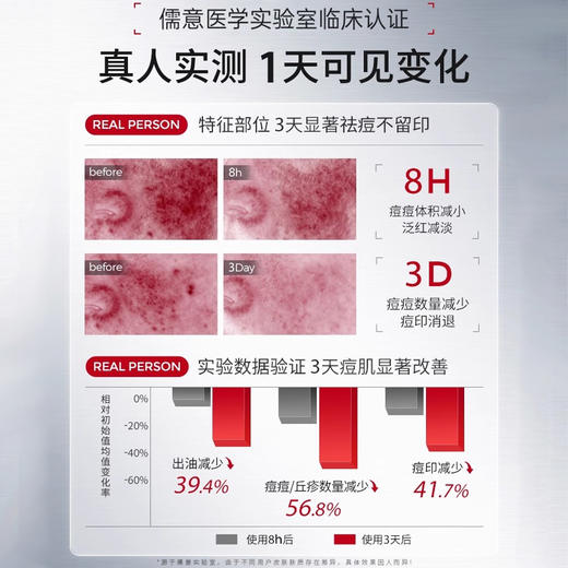 【⚡抢！第2件0元，需拍2件】儒意平衡清透面霜50g  祛痘印修复舒缓淡化痘印美白提亮祛斑保湿滋润补水敏肌用|儒意官方旗舰店 商品图3