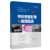 甲状旁腺影像和病理图谱 美亚历山大 希夫林 等主编 沈志森 邬振华主译 右上甲状旁腺腺瘤 上海科学技术出版社 9787547867822 商品缩略图2