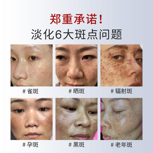 I祛斑养白霜50g祛斑美白淡化斑点 商品图1