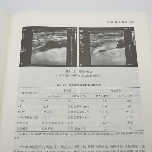 康复影像学指南(王振常) 商品图4