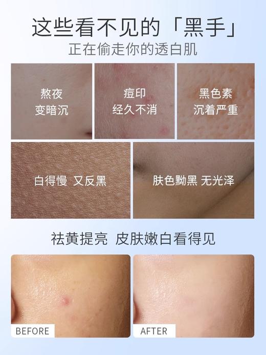 【褪黑淡黄 更亮一度】烟酰胺美白精华露30ml#烟酰胺精华液改善暗沉提亮补水保湿淡化印痕收缩毛孔美白原液 商品图1