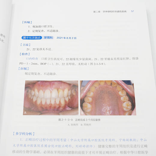 牙体牙髓病多学科诊疗病例精粹(凌均棨) 商品图4