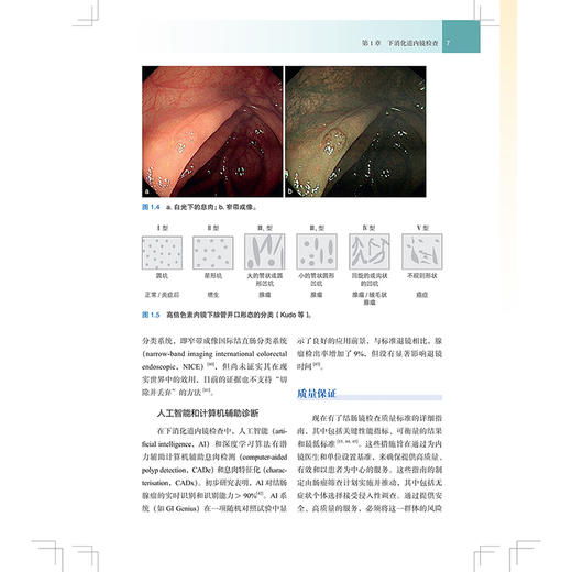 正版 结直肠外科临床精要 下消化道内镜检查 结直肠癌和遗传学 直肠恶性肿瘤手术 许剑民 主译 上海科学技术出版社 9787547865767 商品图4