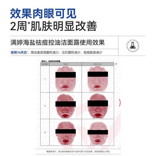 满婷海盐祛痘控油洁面露180ml——加入会员下单享8折，满69元送满婷清满保湿洁面乳，满119元送祛痘控油沐浴乳 商品图5