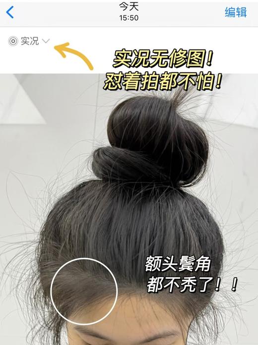 土耳其正品防脱防掉发再秃的头也能养回来洗发水 商品图9