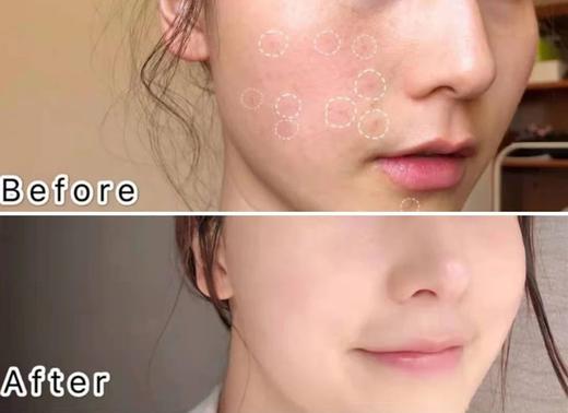 【9.15王炸割肉价】海蓝之谜正装两件套（精粹水150ml+唇膏9g） 商品图3