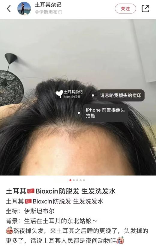 土耳其正品防脱防掉发再秃的头也能养回来洗发水 商品图14