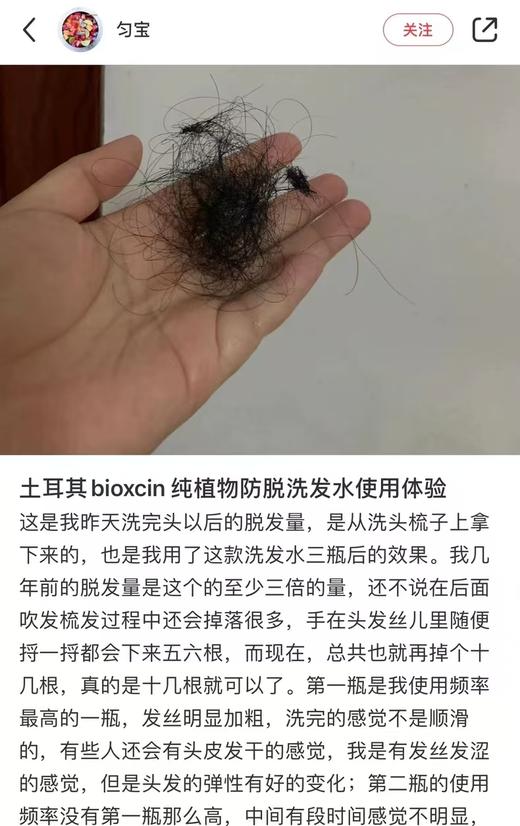 土耳其正品防脱防掉发再秃的头也能养回来洗发水 商品图13