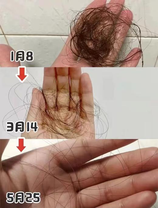 土耳其正品防脱防掉发再秃的头也能养回来洗发水 商品图3