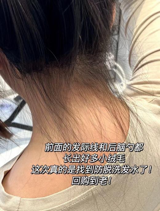 土耳其正品防脱防掉发再秃的头也能养回来洗发水 商品图8