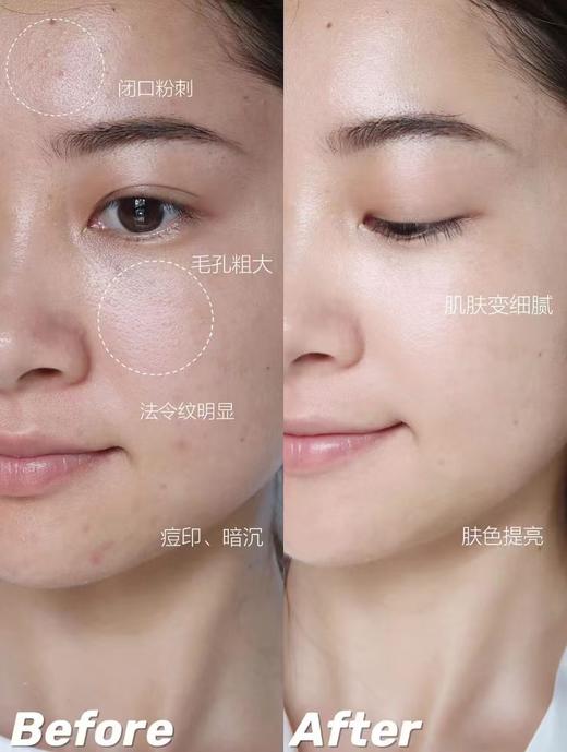 祛黄卓养修复力尊享红石榴晚霜面膜二合一 商品图10