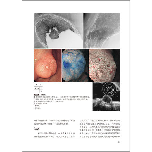 胃与肠 内镜医生也应该了解的上消化道肿瘤病理诊断要点 胃与肠编委会编著 消化内镜内科学书籍 辽宁科学技术出版社9787559134806 商品图4