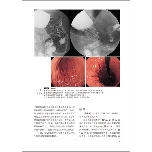 胃与肠 内镜医生也应该了解的上消化道肿瘤病理诊断要点 胃与肠编委会编著 消化内镜内科学书籍 辽宁科学技术出版社9787559134806 商品图3