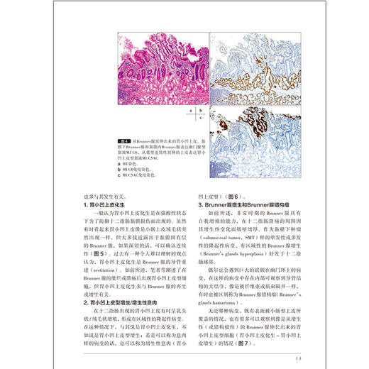 胃与肠 十二指肠非乳头区腺瘤和腺癌的诊断和治疗 日本 胃与肠编委会 编著 消化内镜 辽宁科学技术出版社9787559136619 商品图3